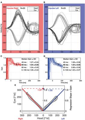 Vestibulo-Ocular Reflex Is Modulated by Noisy Galvanic Vestibular Stimulation